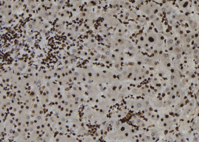 ZC3HAV1 Antibody in Immunohistochemistry (Paraffin) (IHC (P))