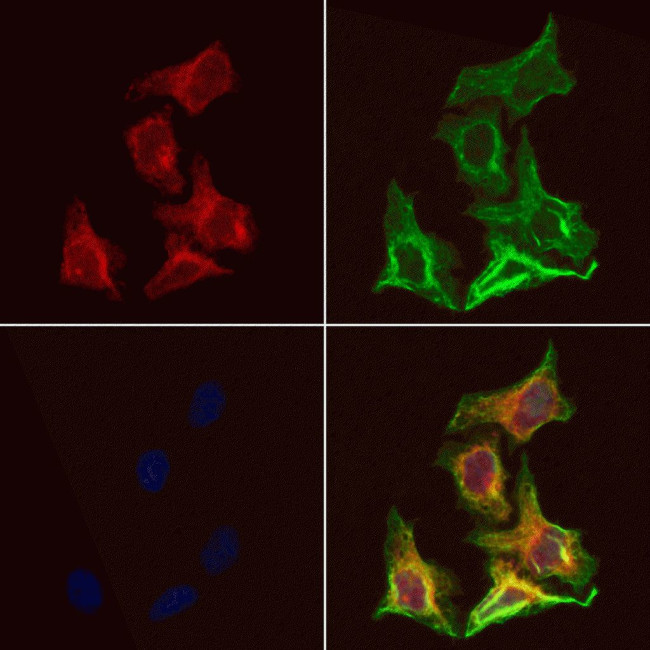 ALP Antibody in Immunocytochemistry (ICC/IF)