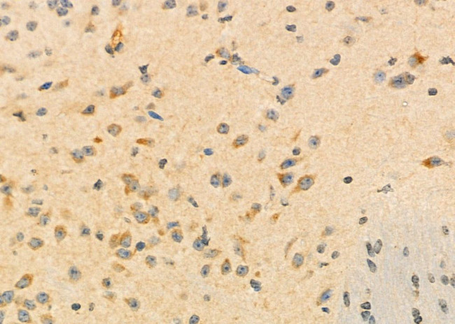 ALP Antibody in Immunohistochemistry (Paraffin) (IHC (P))