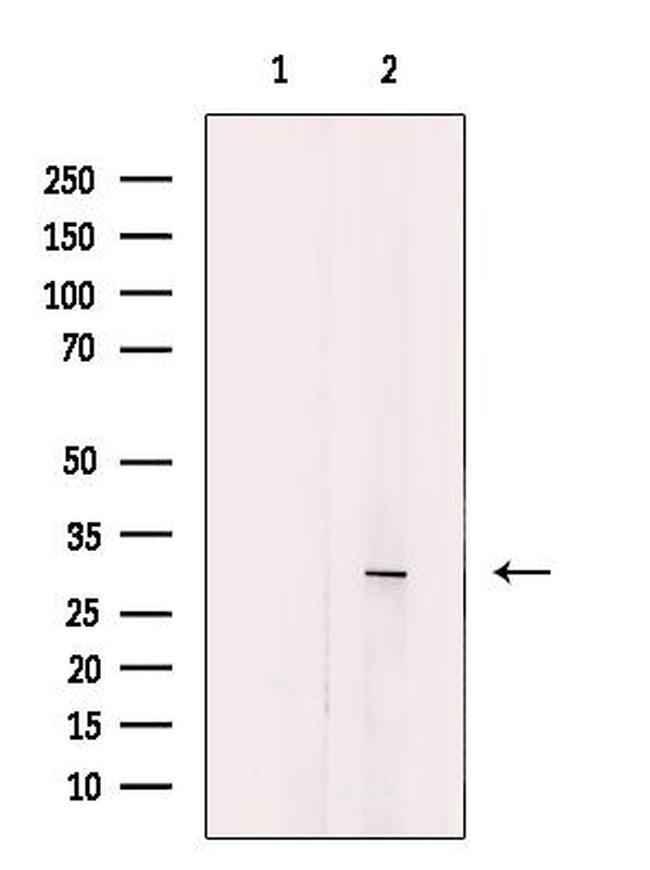 ALP Antibody in Western Blot (WB)