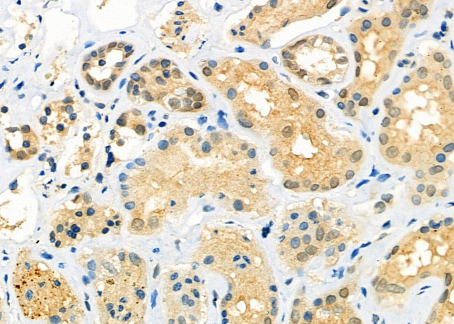 RTRAF Antibody in Immunohistochemistry (Paraffin) (IHC (P))