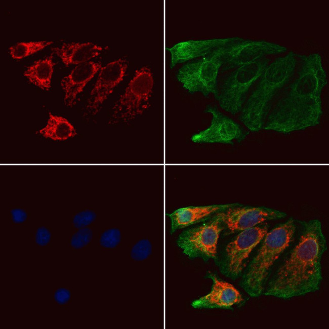 CPLX2 Antibody in Immunocytochemistry (ICC/IF)