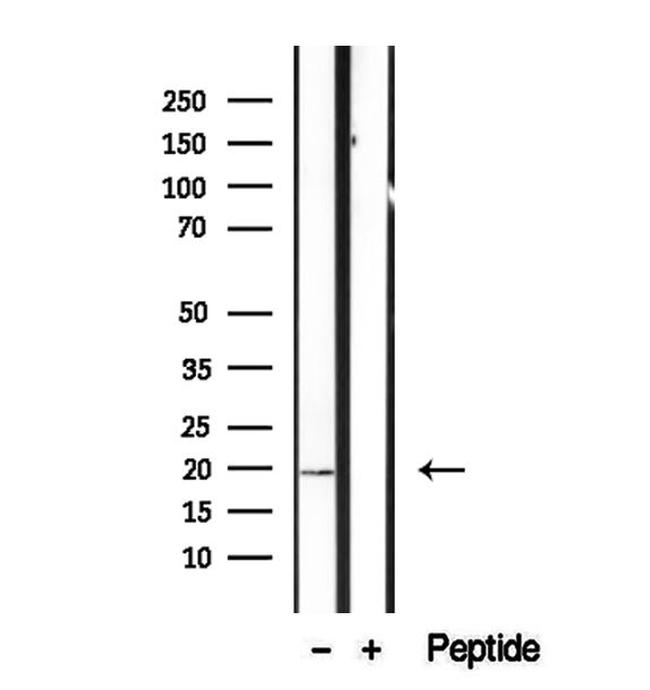 CPLX2 Antibody in Western Blot (WB)