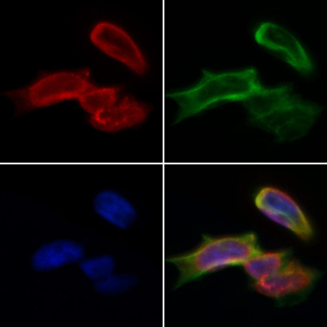 CPS1 Antibody in Immunocytochemistry (ICC/IF)