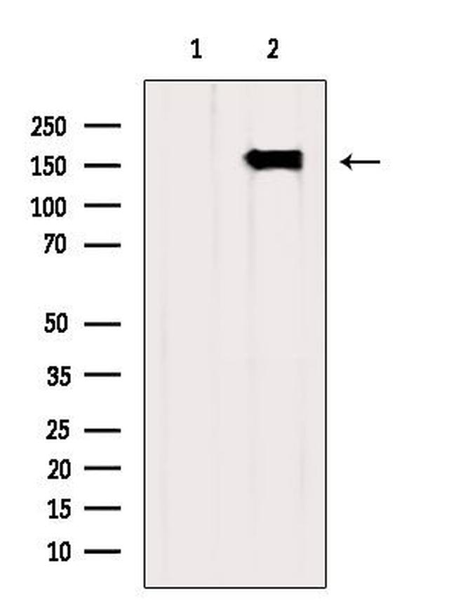 CPS1 Antibody in Western Blot (WB)