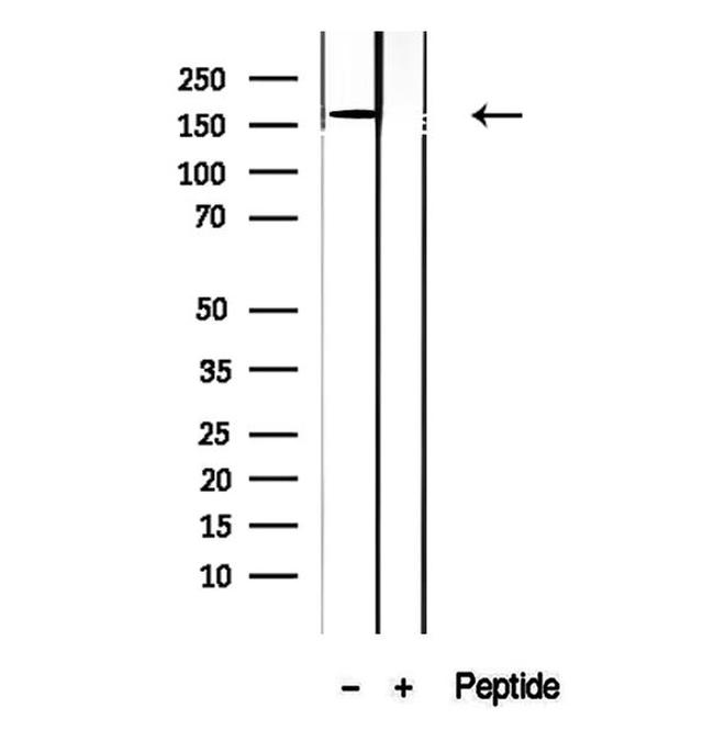 CPS1 Antibody in Western Blot (WB)