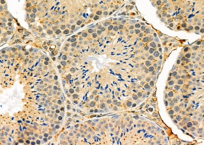 CXCL14 Antibody in Immunohistochemistry (Paraffin) (IHC (P))