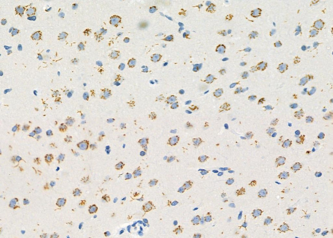 CXCL14 Antibody in Immunohistochemistry (Paraffin) (IHC (P))