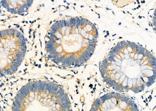 Cyclophilin C Antibody in Immunohistochemistry (Paraffin) (IHC (P))