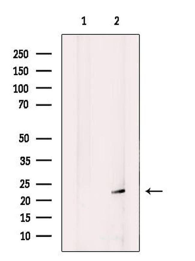 Cyclophilin C Antibody in Western Blot (WB)