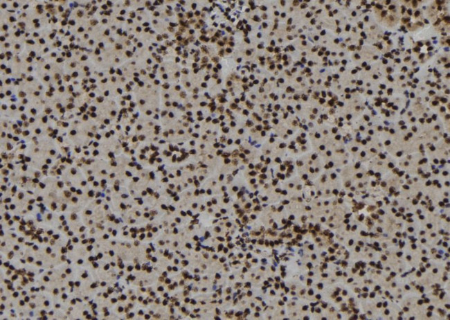 E2F3 Antibody in Immunohistochemistry (Paraffin) (IHC (P))