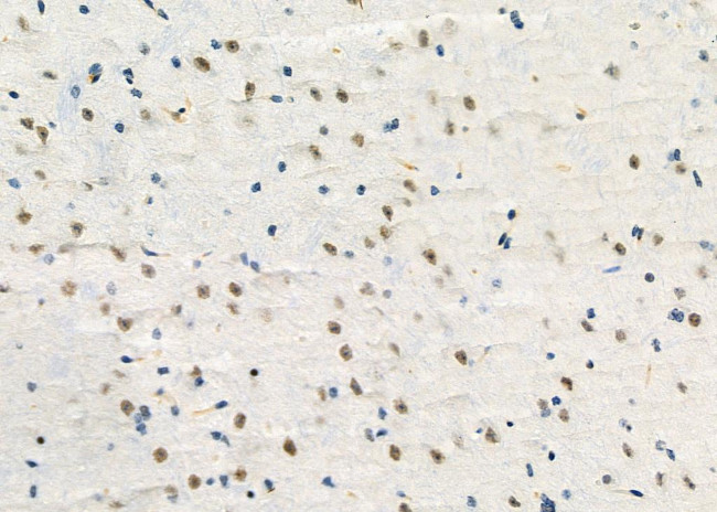 E2F3 Antibody in Immunohistochemistry (Paraffin) (IHC (P))