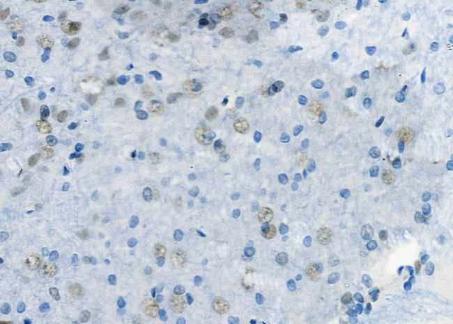 E2F3 Antibody in Immunohistochemistry (Paraffin) (IHC (P))