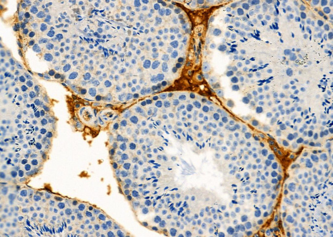 eIF2b alpha Antibody in Immunohistochemistry (Paraffin) (IHC (P))