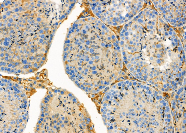 GREM2 Antibody in Immunohistochemistry (Paraffin) (IHC (P))