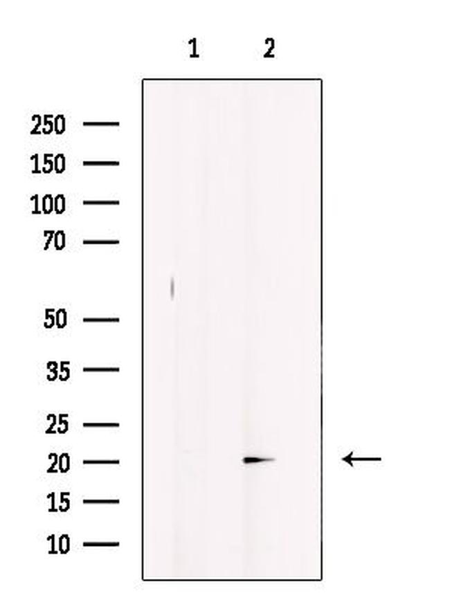 GREM2 Antibody in Western Blot (WB)