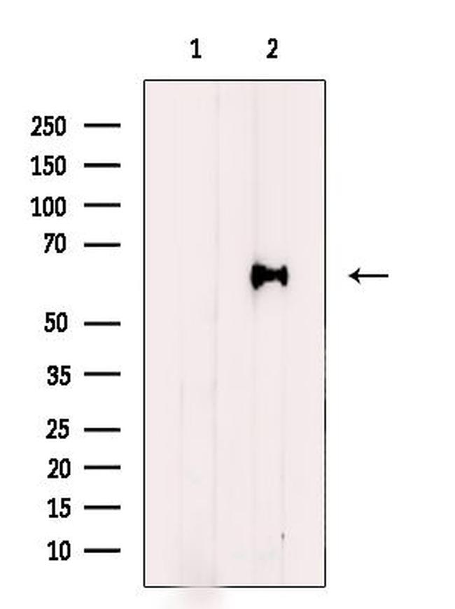 HPSE Antibody in Western Blot (WB)