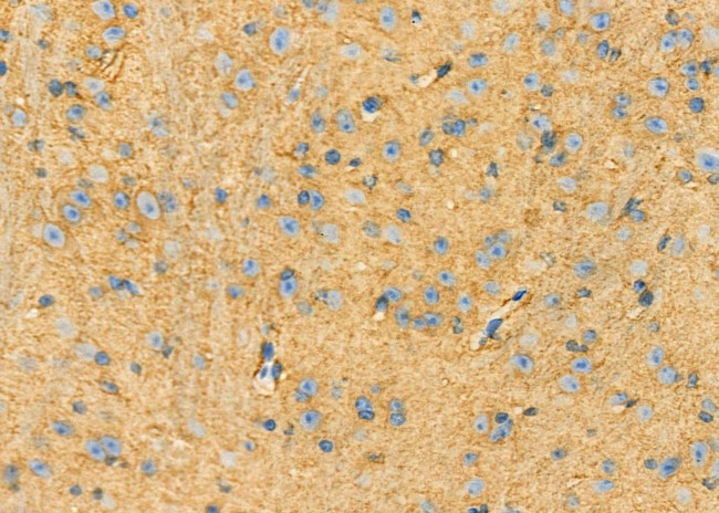 LGP2 Antibody in Immunohistochemistry (Paraffin) (IHC (P))