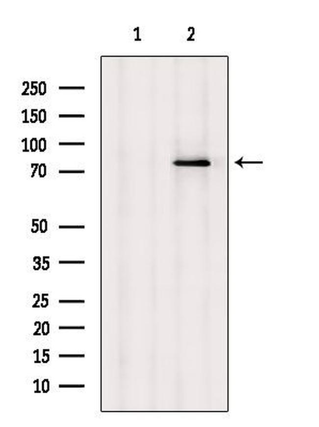 LGP2 Antibody in Western Blot (WB)