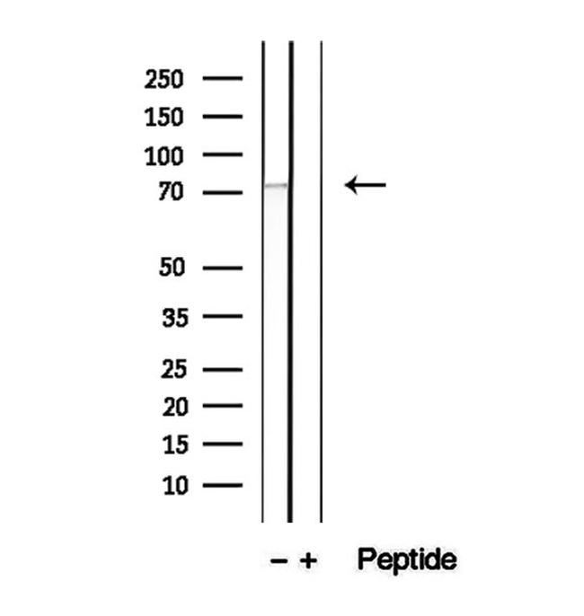 LGP2 Antibody in Western Blot (WB)