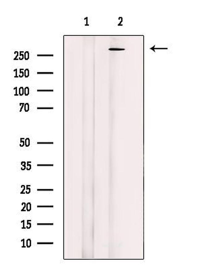 MAP1B Antibody in Western Blot (WB)