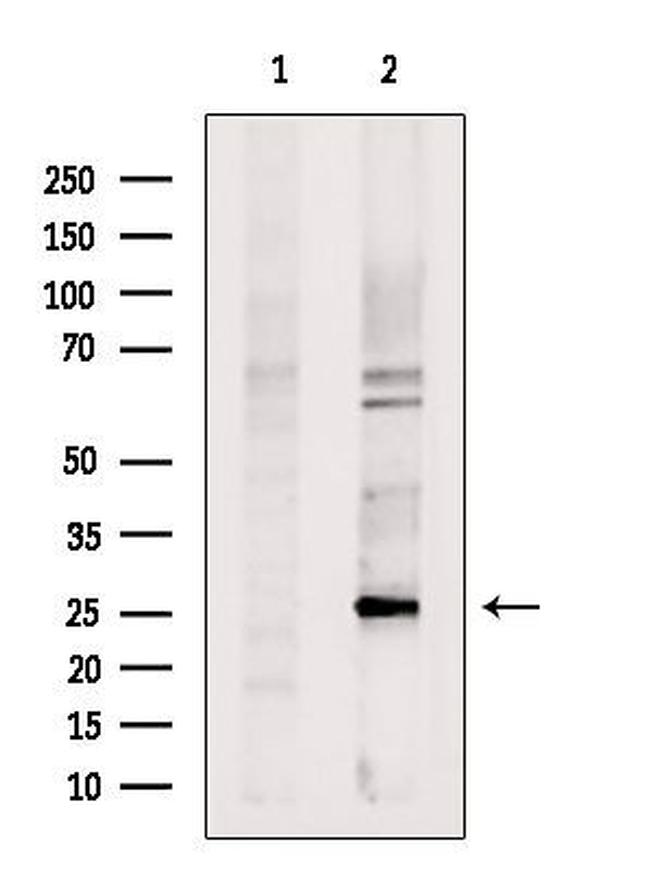 PCMT1 Antibody in Western Blot (WB)