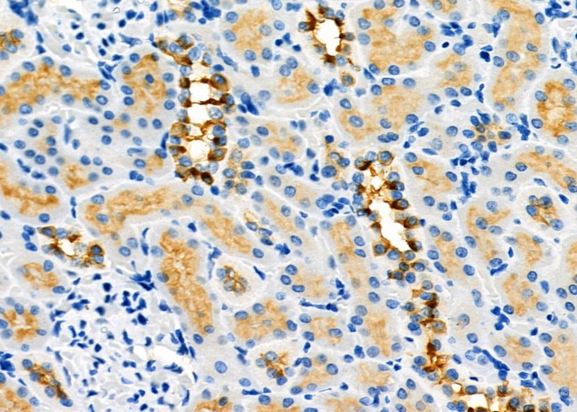 PDHB Antibody in Immunohistochemistry (Paraffin) (IHC (P))