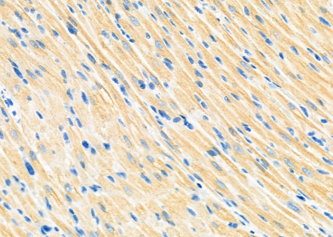 PIP5K1A Antibody in Immunohistochemistry (Paraffin) (IHC (P))