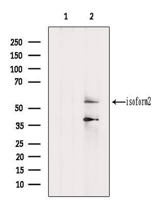 PIP5K1A Antibody in Western Blot (WB)