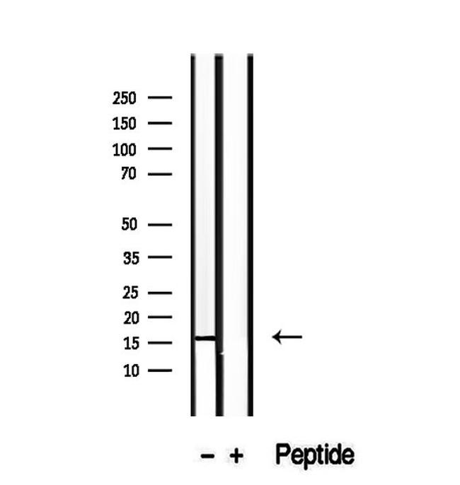 RPS14 Antibody in Western Blot (WB)