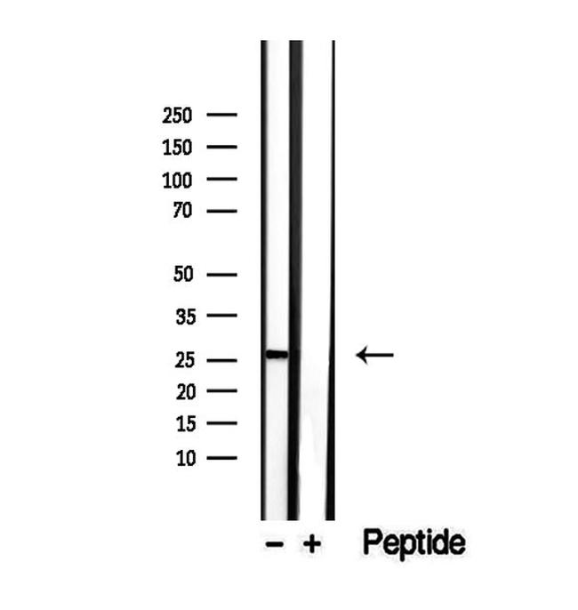 SAT1 Antibody in Western Blot (WB)