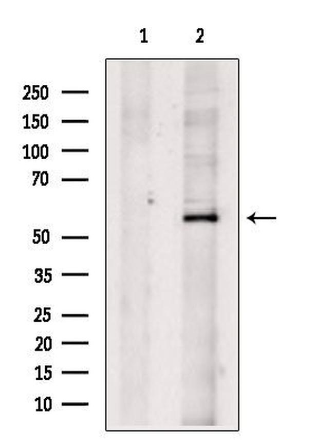 SLC13A2 Antibody in Western Blot (WB)