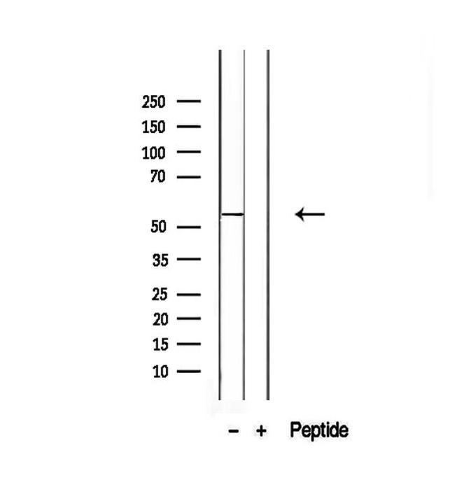 SLC13A2 Antibody in Western Blot (WB)