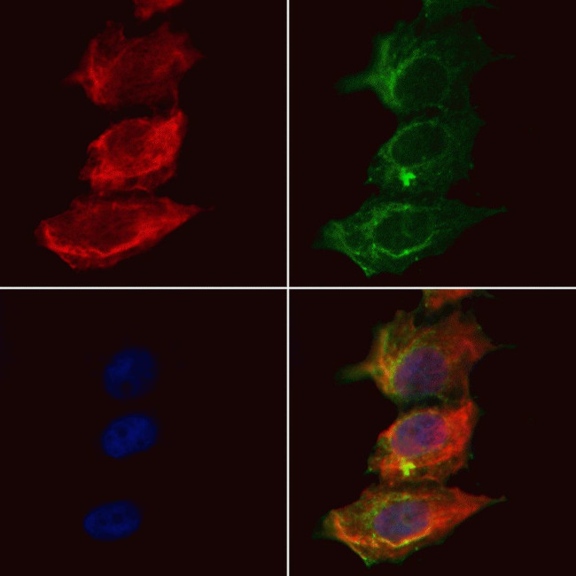 TBC1D23 Antibody in Immunocytochemistry (ICC/IF)