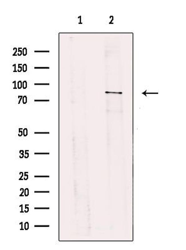 TBC1D23 Antibody in Western Blot (WB)