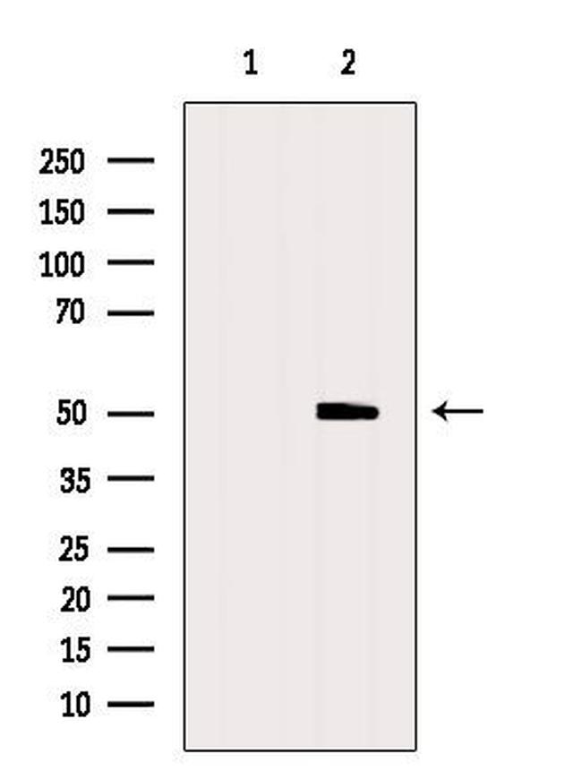 TRIM14 Antibody in Western Blot (WB)