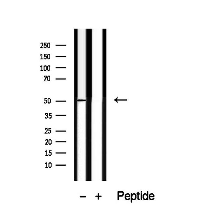 TRIM14 Antibody in Western Blot (WB)