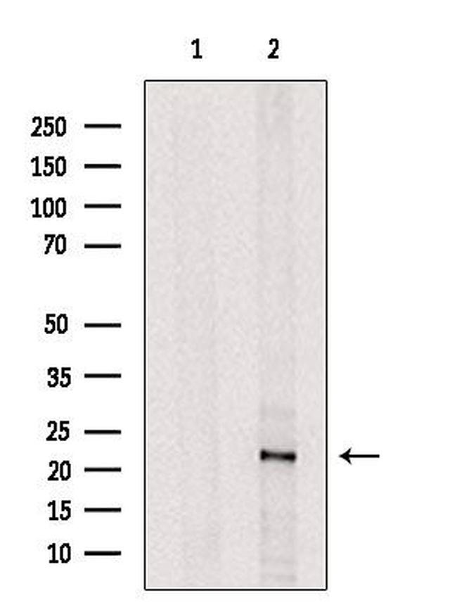 UBE2E2 Antibody in Western Blot (WB)