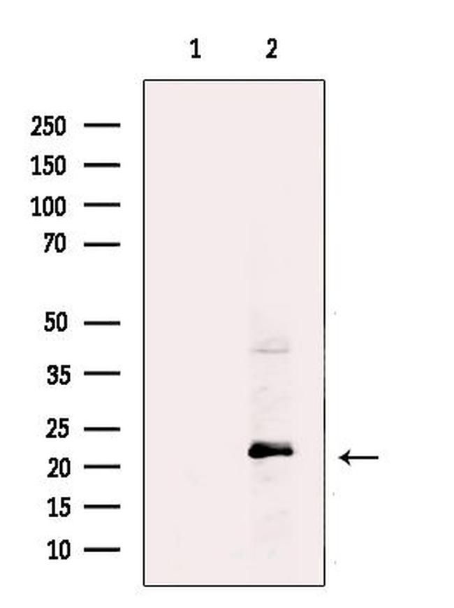 UBE2E2 Antibody in Western Blot (WB)