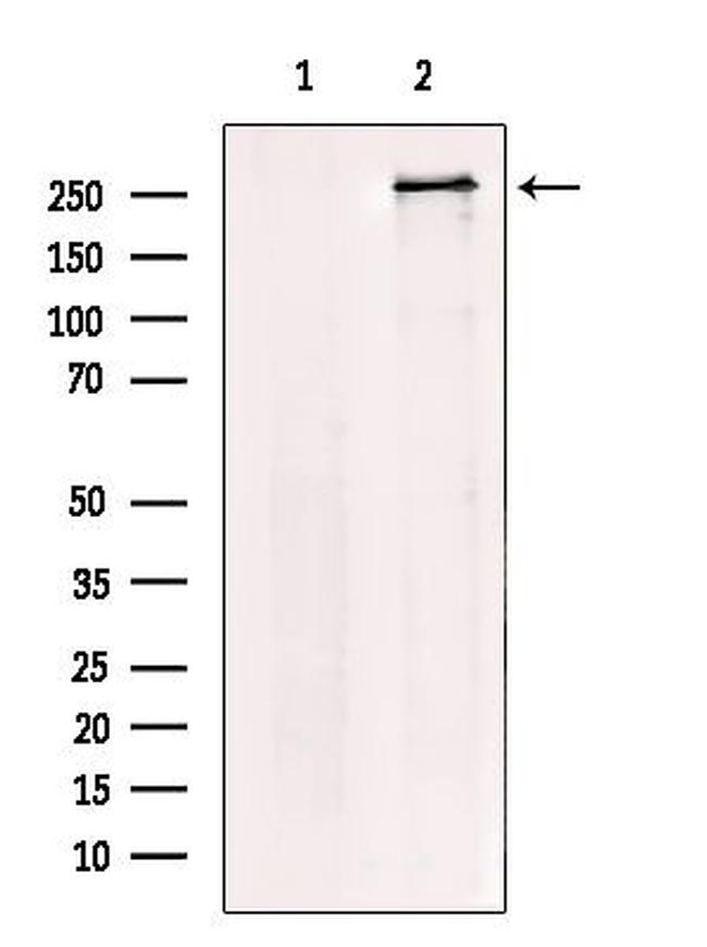 USP9X Antibody in Western Blot (WB)