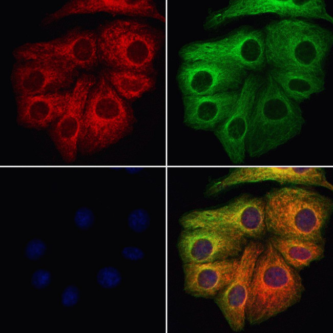 VPS11 Antibody in Immunocytochemistry (ICC/IF)