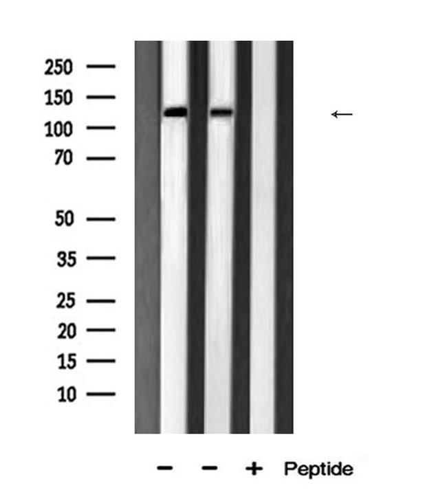 JMY Antibody in Western Blot (WB)