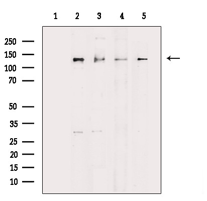 JMY Antibody in Western Blot (WB)