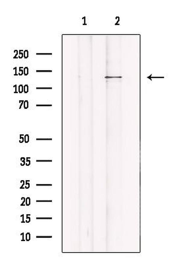 JMY Antibody in Western Blot (WB)