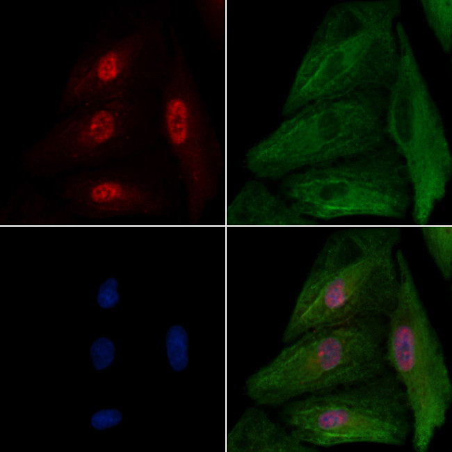 NR2F6 Antibody in Immunocytochemistry (ICC/IF)