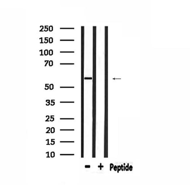 HARS Antibody in Western Blot (WB)