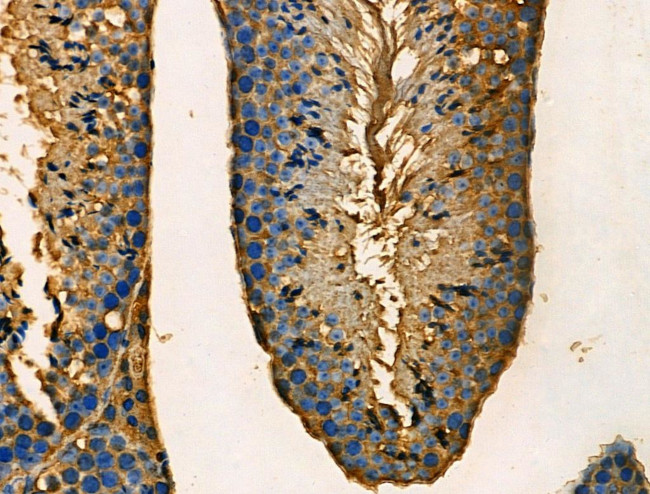 PRKAR2A Antibody in Immunohistochemistry (Paraffin) (IHC (P))