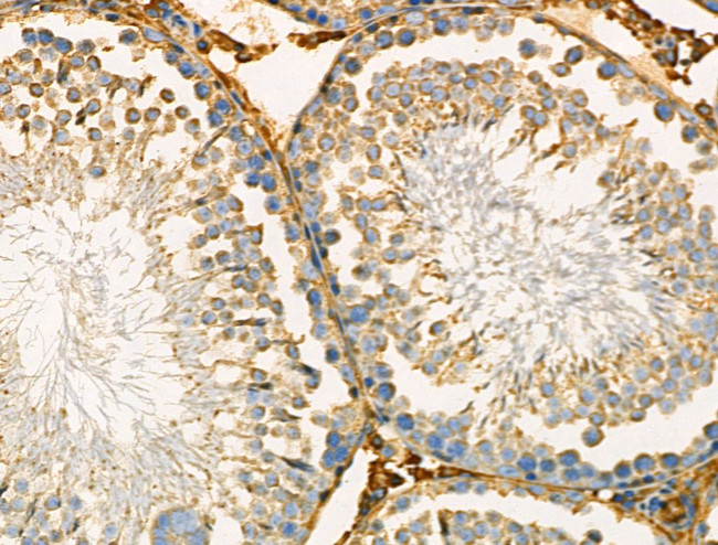 PRKAR2A Antibody in Immunohistochemistry (Paraffin) (IHC (P))