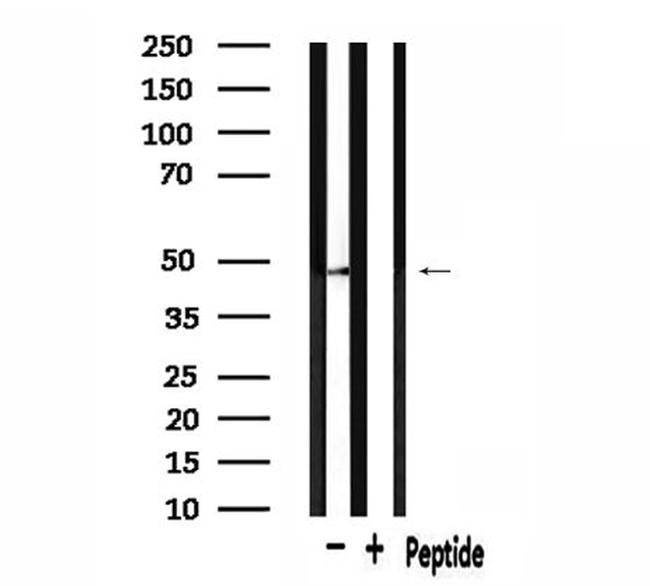 PRKAR2A Antibody in Western Blot (WB)