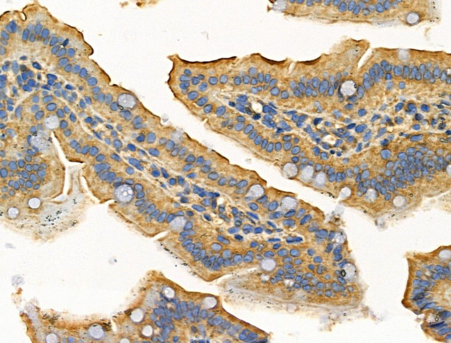 MARK3 Antibody in Immunohistochemistry (Paraffin) (IHC (P))